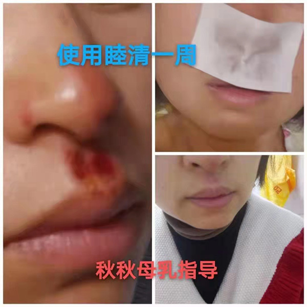 �����澏���N���Æ������M(f��i)�߿ڱ���������(sh��)���a(ch��n)ƷȦ�۟o��(sh��)